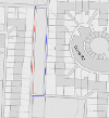 Footpath closures in Armadale